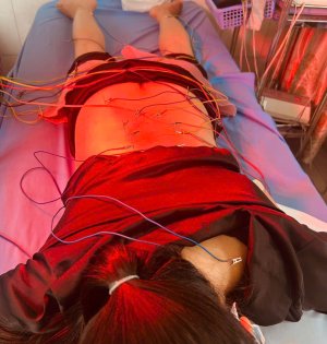 BỆNH NHÂN CHÂM CỨU ĐIỀU TRỊ ĐAU THẦN KINH TỌA
