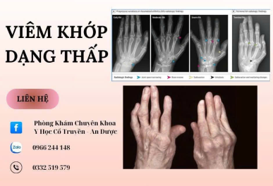 Điều Trị Viêm Khớp Dạng Thấp Thủ Đức Bằng Đông Y An Toàn