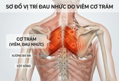 Viêm Cơ Trám Y Học Cổ Truyền Gần Đây: Địa Chỉ Khám Uy Tín TP.HCM