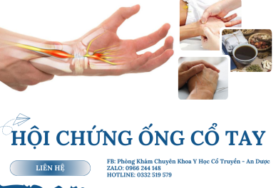 Châm cứu điều trị hội chứng ống cổ tay tại Đông Y An Dược Thủ Đức