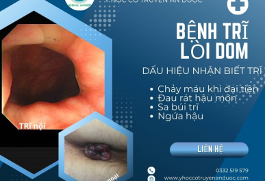 Điều Trị Bệnh Trĩ Ở TP Hồ Chí Minh Chuẩn YHCT Kết Hợp YHĐĐ