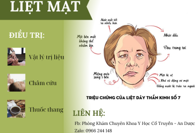 Điều Trị Liệt Dây Thần Kinh 7 Thủ Đức Bằng Đông Y An Toàn