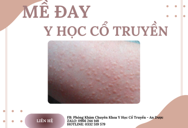 Trị Mày Đay Bằng Y Học Cổ Truyền Tại Thủ Đức | YHCT An Dược