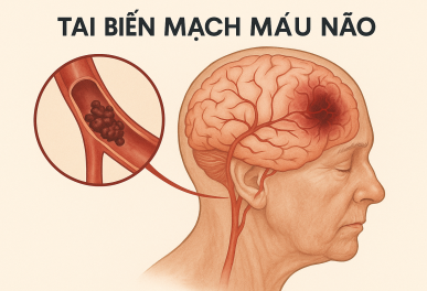 Điều trị tai biến mạch máu não tại Hồ Chí Minh uy tín hàng đầu
