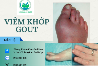 Điều Trị Gout Thống Phong Tại Hiệp Bình Thủ Đức Uy Tín